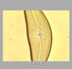 CLE Nikon PlanApo 60x / 0.95 160/0.11-0.23 Microscope Objective Lens RMS 34670