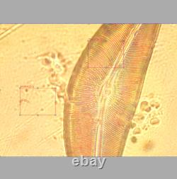 Olympus NCSPlan Apo 60X 0.90 160/0 Microscope Ob Lens for RMS 33586