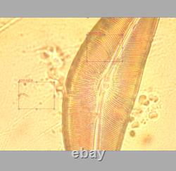 Olympus NCSPlan Apo 60X 0.90 160/0 Microscope Ob Lens for RMS 33586